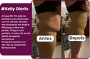 Modelador de Cintura e Barriga Empina Bumbum - Up Shaper®