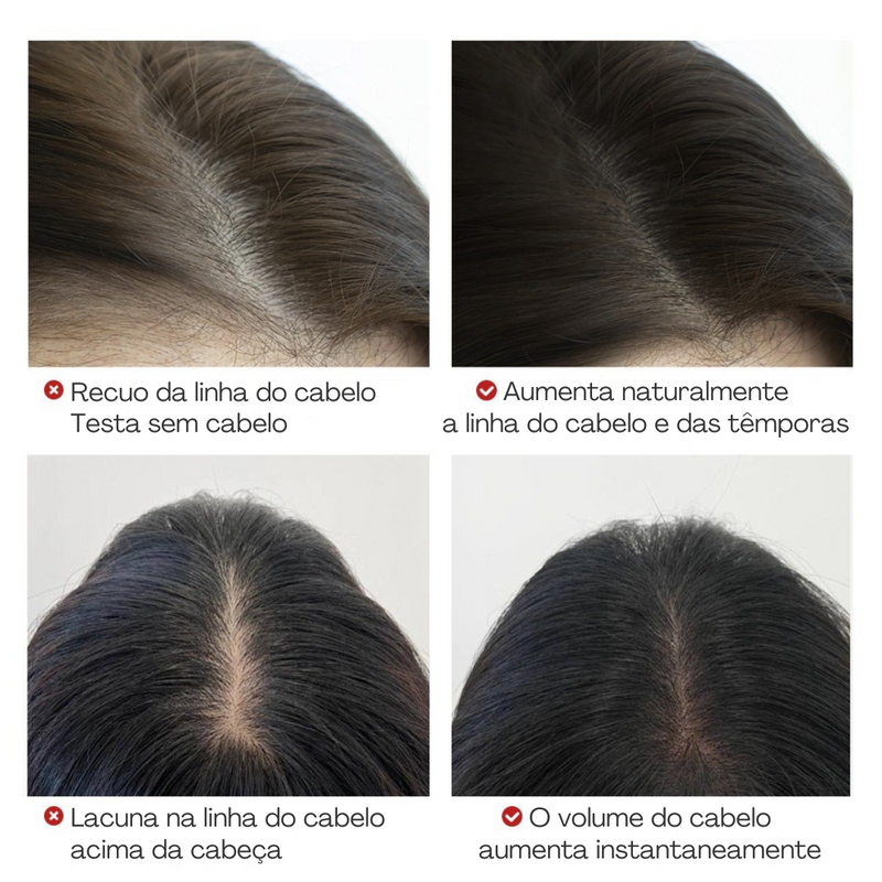 Preenchedor de Falhas Capilares - FullLine Stick®