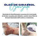 Óleo de Girassol Ozonizado - Ozonteck®